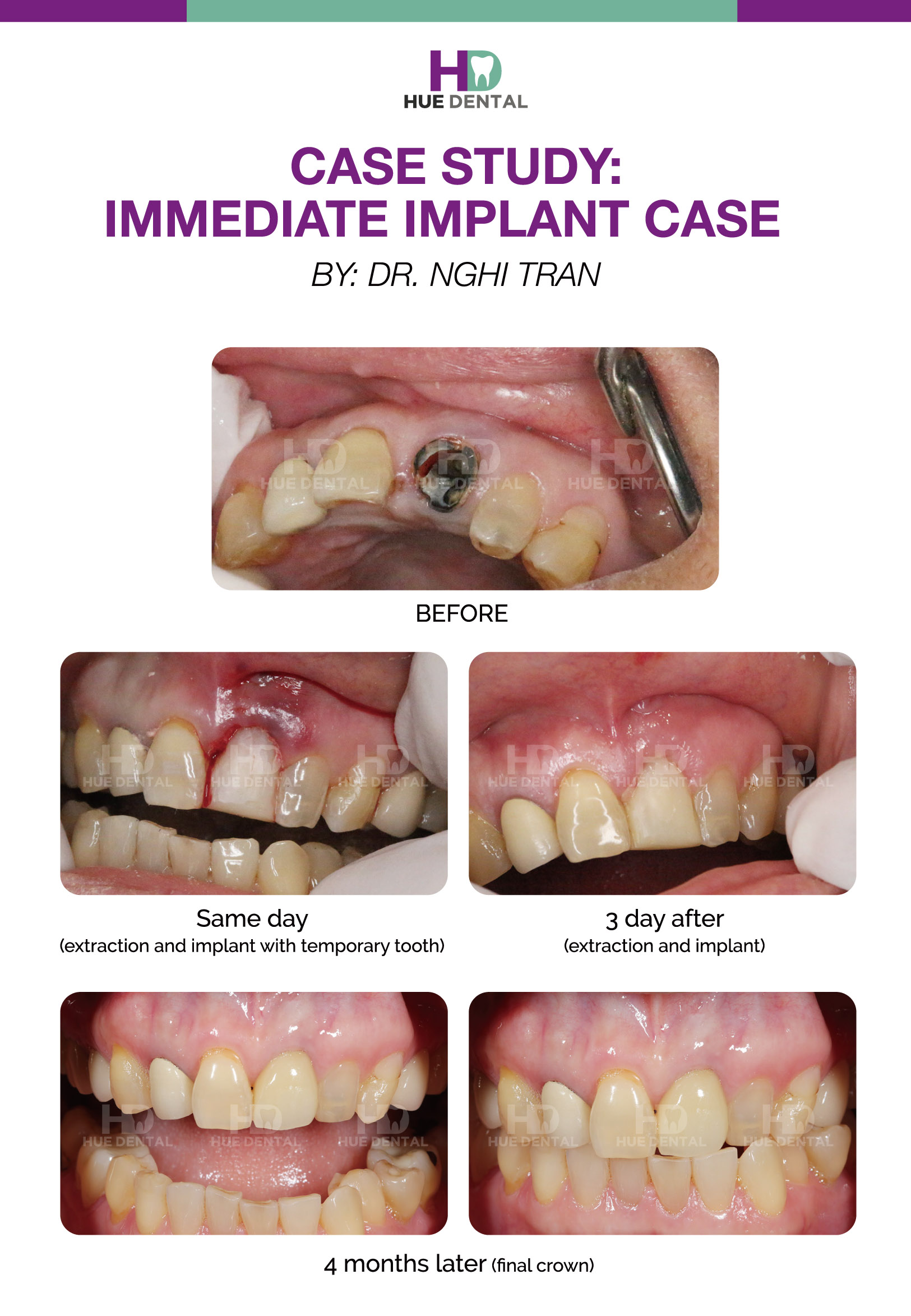 Dental case study presentation image
